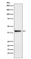 Anti-Alcohol Dehydrogenase Rabbit Monoclonal Antibody